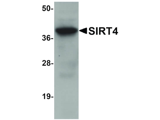 SIRT4 Antibody in Western Blot (WB)