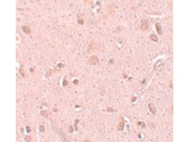 TINP1 Antibody in Immunohistochemistry (Paraffin) (IHC (P))