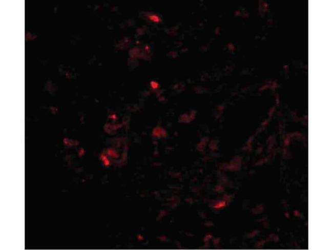 Transthyretin Antibody in Immunocytochemistry (ICC/IF)