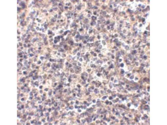 ATG5 Antibody in Immunohistochemistry (Paraffin) (IHC (P))