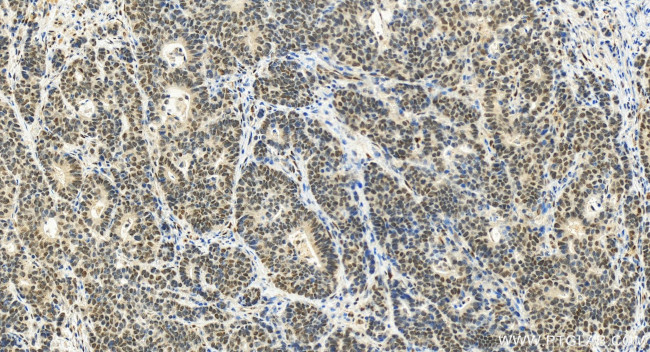 TP53BP1 Antibody in Immunohistochemistry (Paraffin) (IHC (P))