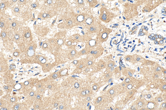 CYP4F2 Antibody in Immunohistochemistry (Paraffin) (IHC (P))