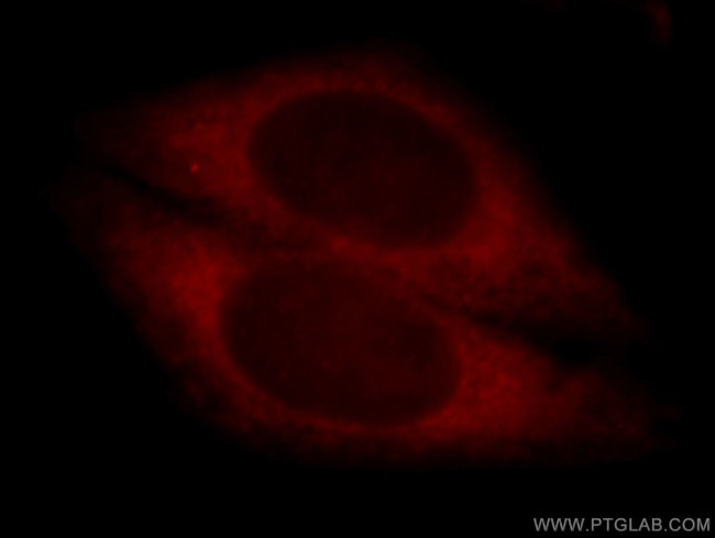 CYP4F11 Antibody in Immunocytochemistry (ICC/IF)