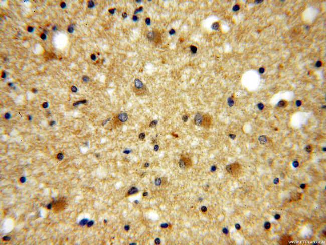 GPRASP1 Antibody in Immunohistochemistry (Paraffin) (IHC (P))
