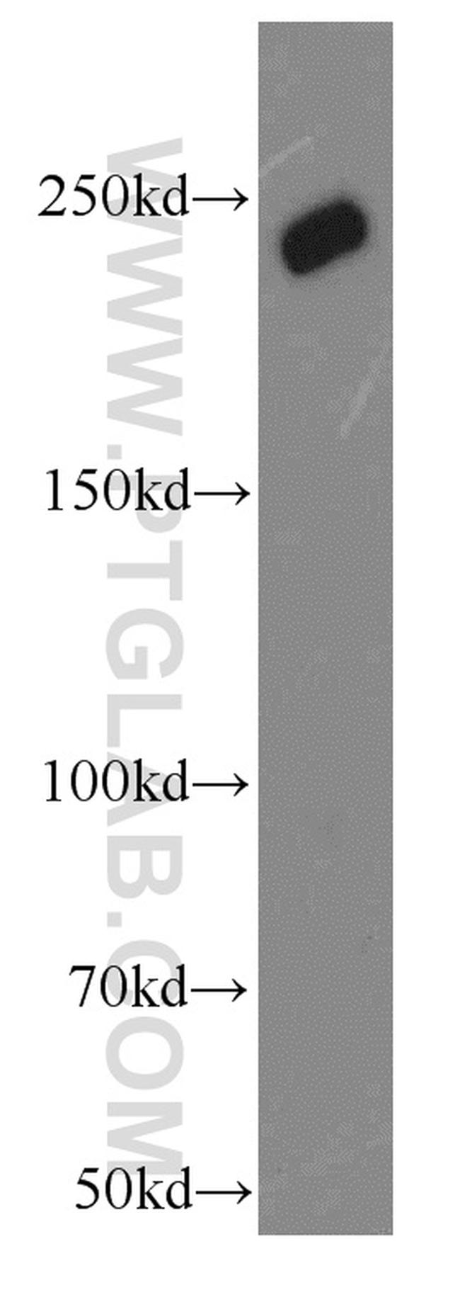 URB1 Antibody in Western Blot (WB)