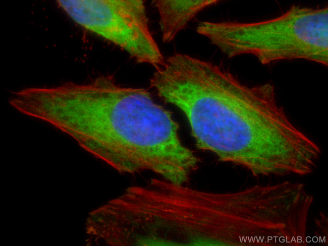 TBC1D4 Antibody in Immunocytochemistry (ICC/IF)