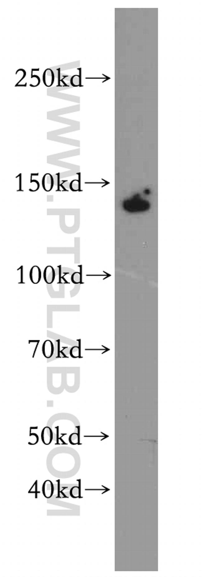 ZBTB40 Antibody in Western Blot (WB)