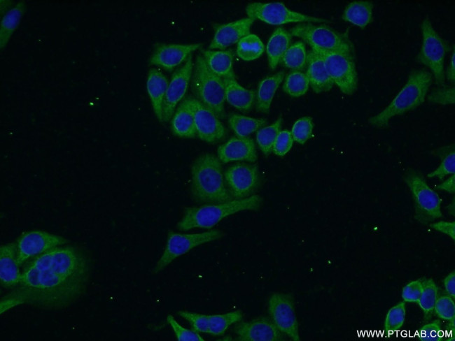 DLEC1 Antibody in Immunocytochemistry (ICC/IF)