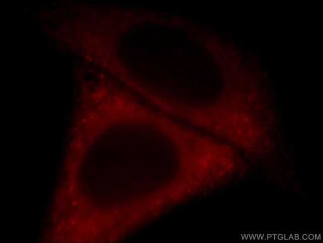NCOA3 Antibody in Immunocytochemistry (ICC/IF)