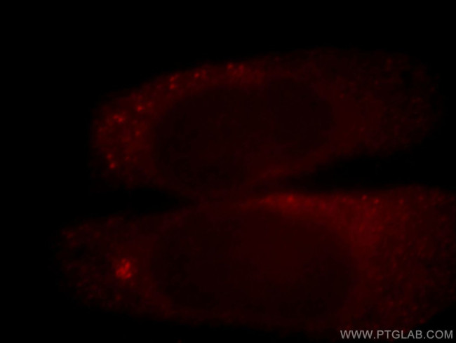 CIT Antibody in Immunocytochemistry (ICC/IF)