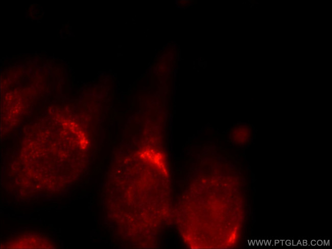 ANKRD26 Antibody in Immunocytochemistry (ICC/IF)