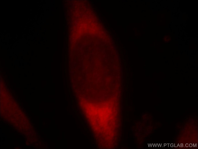PDZD2 Antibody in Immunocytochemistry (ICC/IF)
