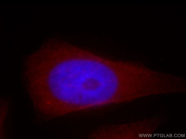 MPRIP Antibody in Immunocytochemistry (ICC/IF)