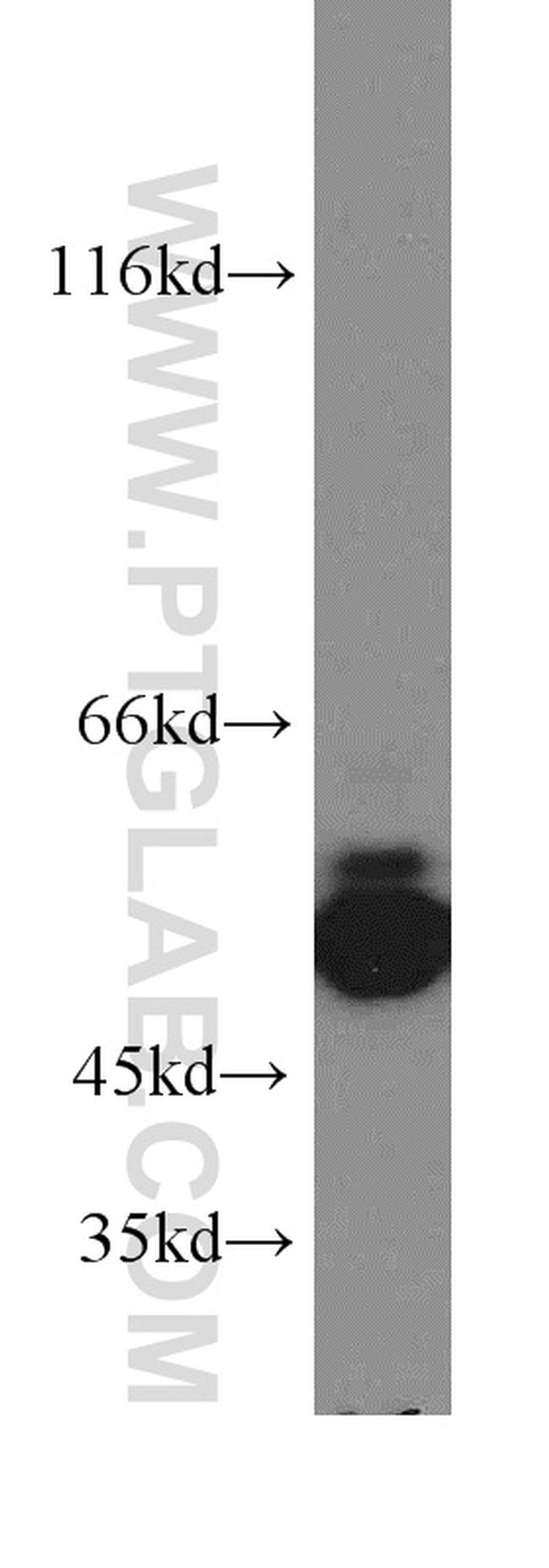 ARHGEF9 Antibody in Western Blot (WB)