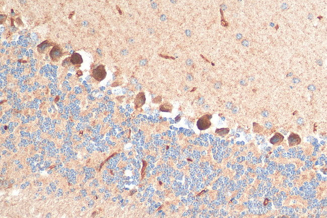 LPHN2 Antibody in Immunohistochemistry (Paraffin) (IHC (P))