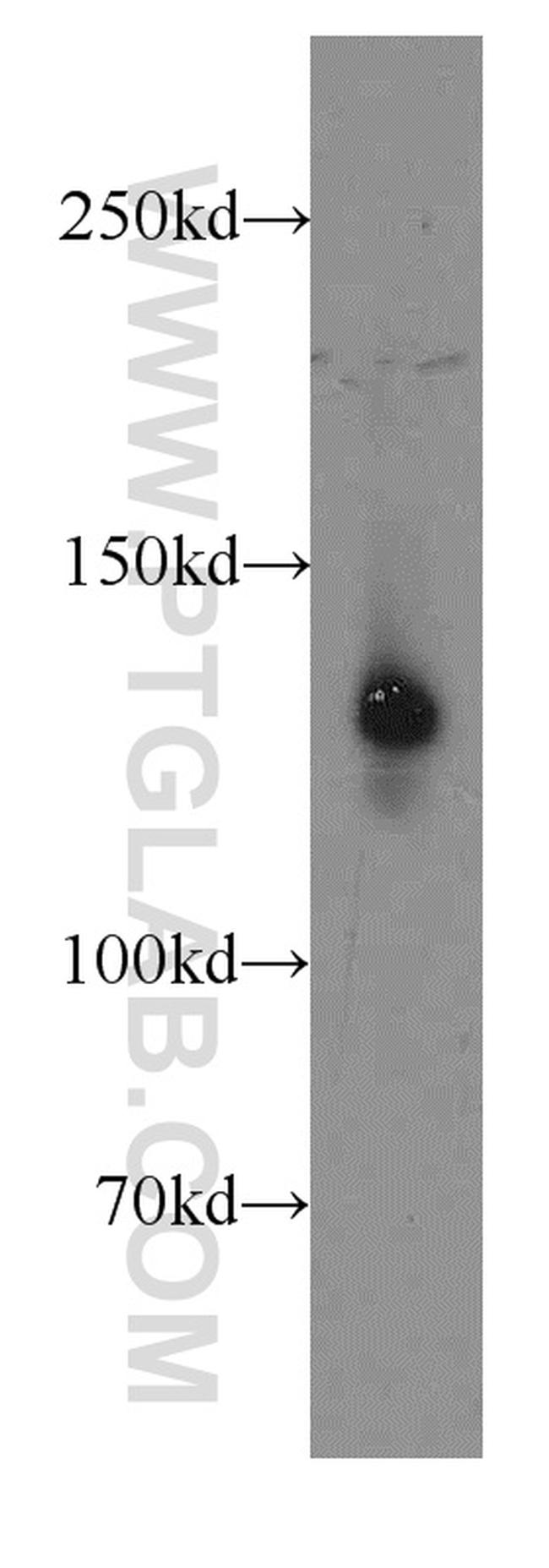 LPHN3 Antibody in Western Blot (WB)