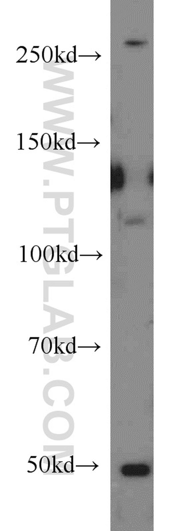 MED12L Antibody in Western Blot (WB)