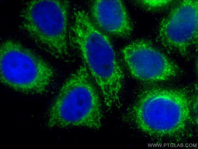 MPC2 Antibody in Immunocytochemistry (ICC/IF)