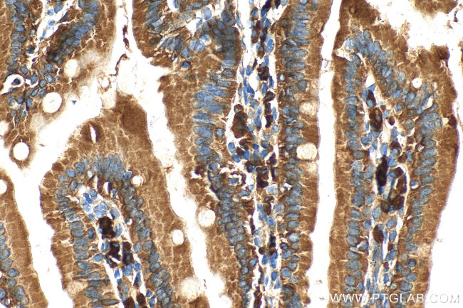 GPR124 Antibody in Immunohistochemistry (Paraffin) (IHC (P))