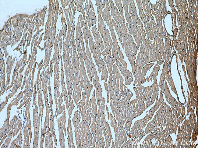 TNS1 Antibody in Immunohistochemistry (Paraffin) (IHC (P))