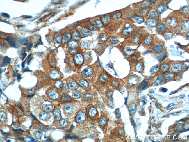 CDH26 Antibody in Immunohistochemistry (Paraffin) (IHC (P))