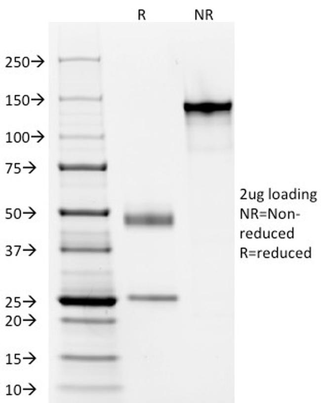 Elastin (ELN) Antibody in SDS-PAGE (SDS-PAGE)