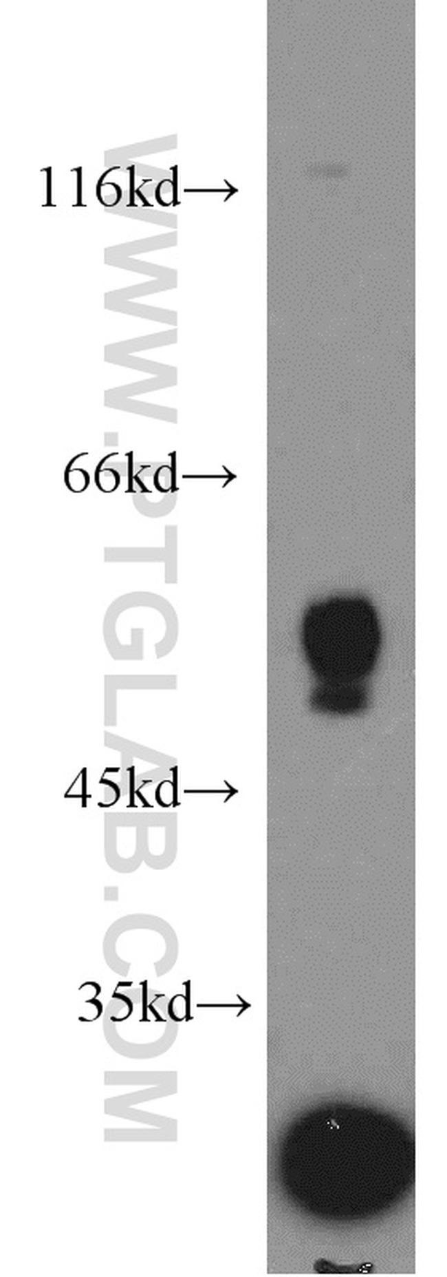 NOX3 Antibody in Western Blot (WB)