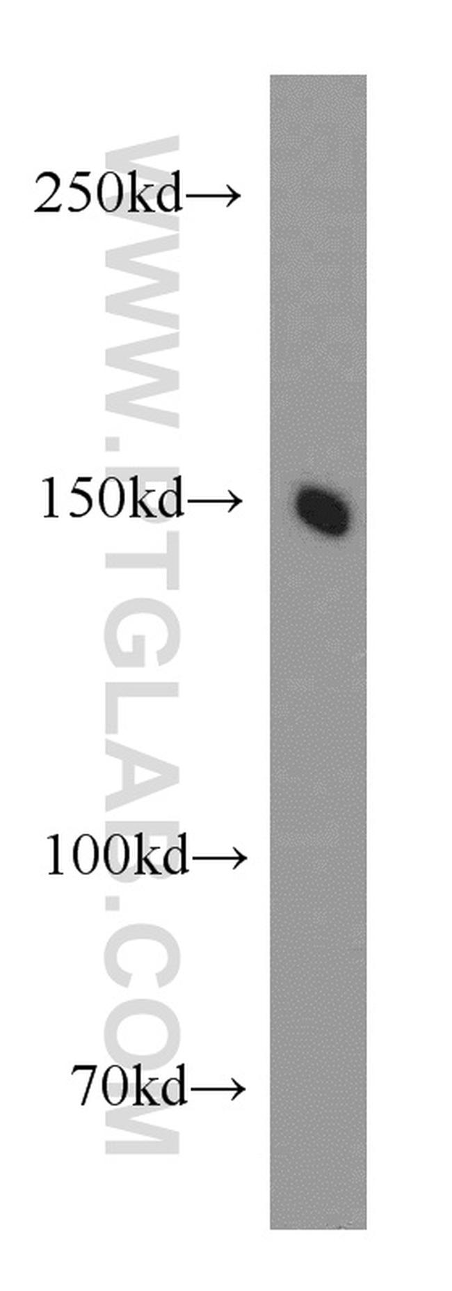 PCDH11Y Antibody in Western Blot (WB)
