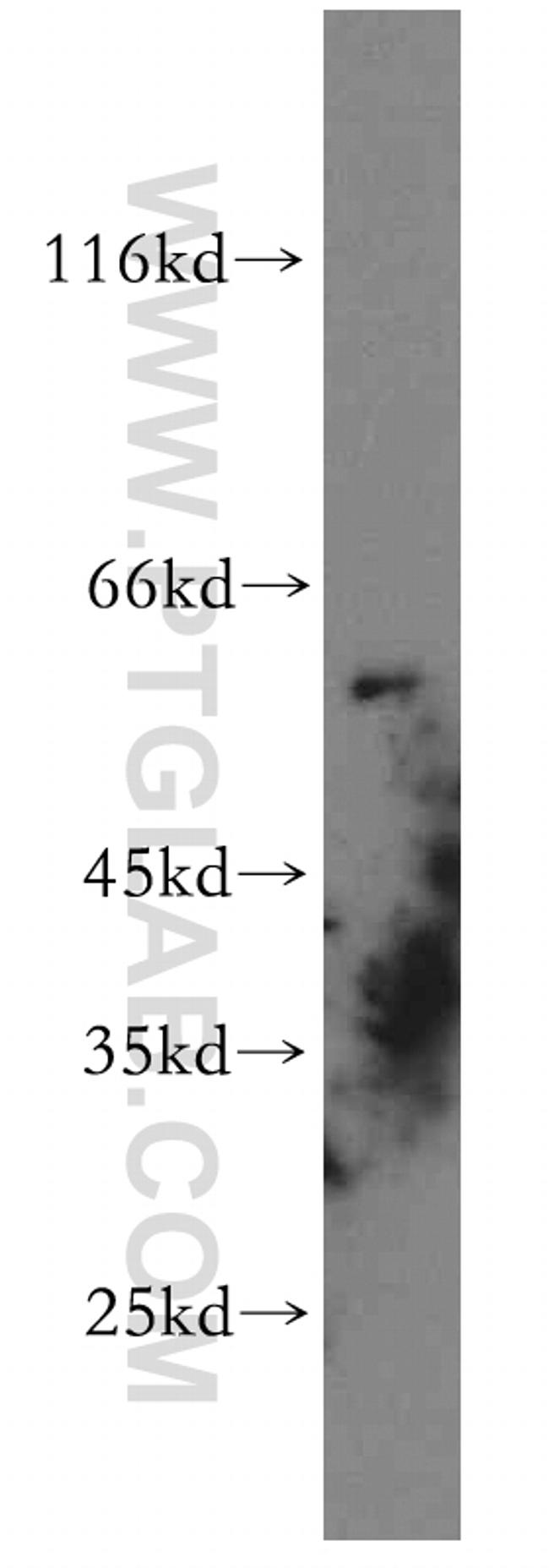 GPR101 Antibody in Western Blot (WB)