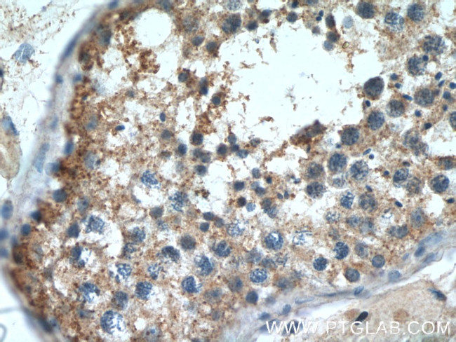 GPR123 Antibody in Immunohistochemistry (Paraffin) (IHC (P))