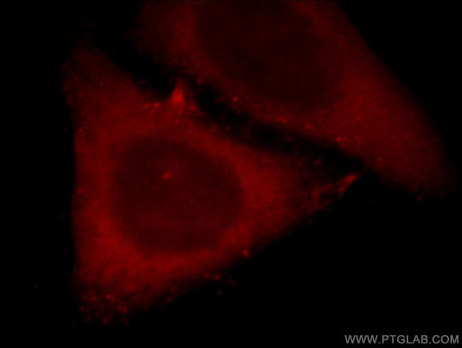 MAS1L Antibody in Immunocytochemistry (ICC/IF)
