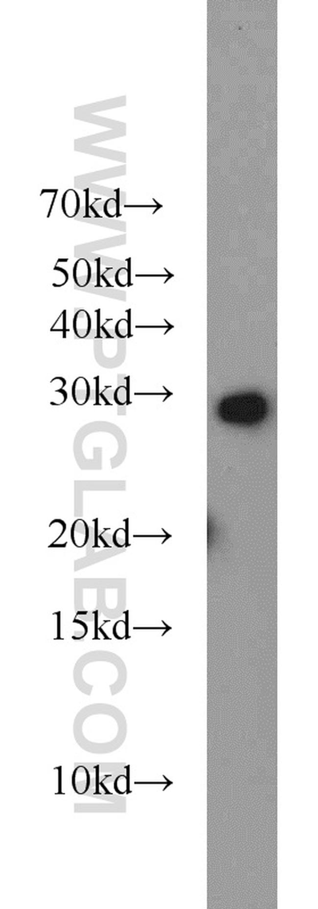 RIMS4 Antibody in Western Blot (WB)