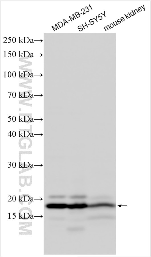 NBPF4 Antibody in Western Blot (WB)