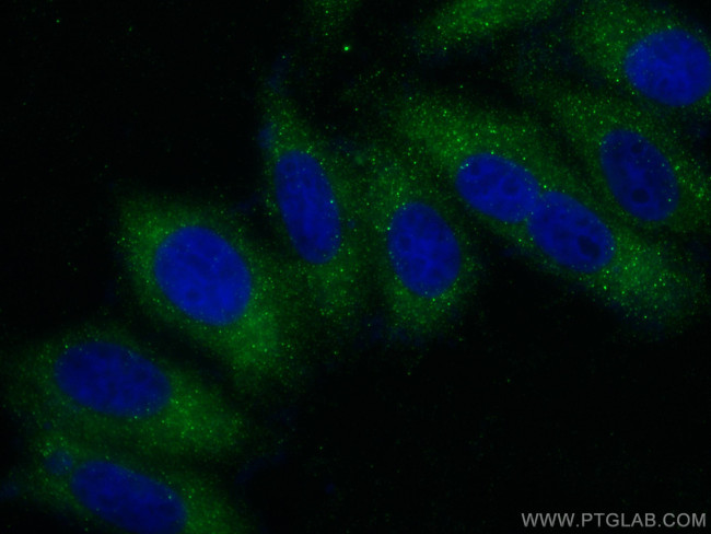 RIPK5 Antibody in Immunocytochemistry (ICC/IF)