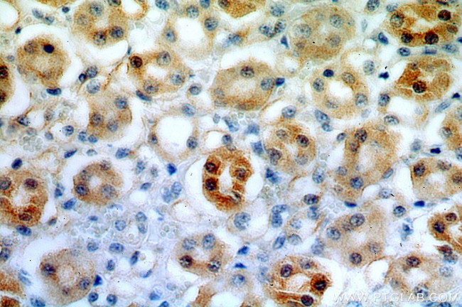 FAM96B Antibody in Immunohistochemistry (Paraffin) (IHC (P))