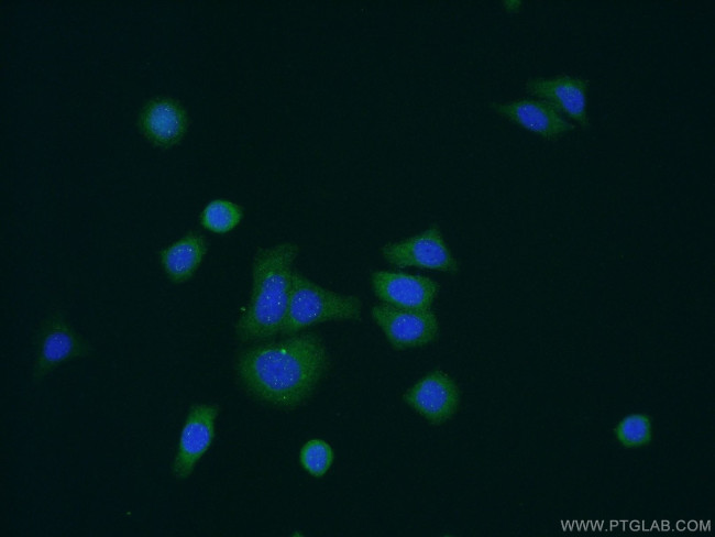 NOSTRIN Antibody in Immunocytochemistry (ICC/IF)