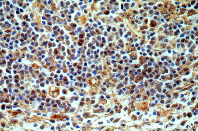 TMCO6 Antibody in Immunohistochemistry (Paraffin) (IHC (P))