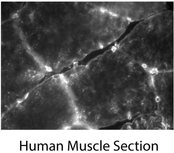 TMEM214 Antibody in Immunohistochemistry (IHC)