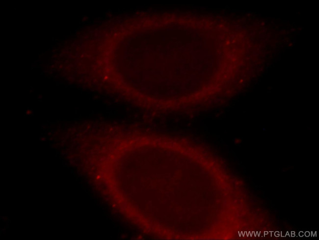 FAM49B Antibody in Immunocytochemistry (ICC/IF)
