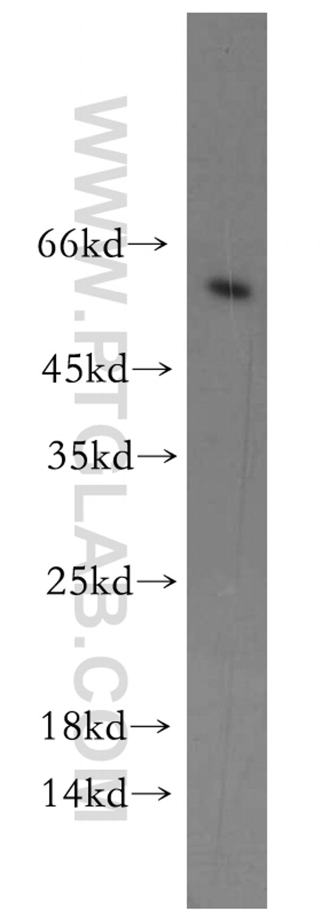 CYP4Z1 Antibody in Western Blot (WB)