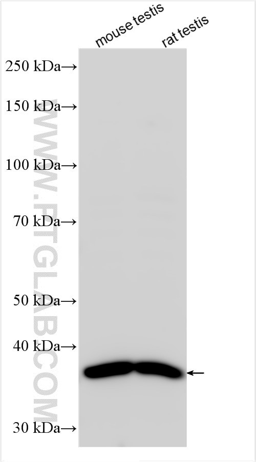 GLB1L3 Antibody in Western Blot (WB)