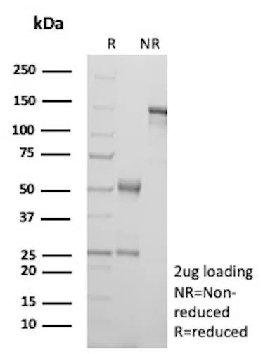 TIGIT/VSTM3/VSIG9 (Immune Checkpoint for Cancer) Antibody in SDS-PAGE (SDS-PAGE)