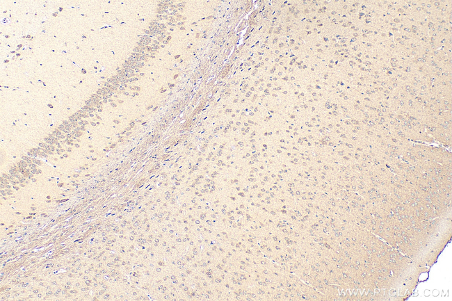 PDZD4 Antibody in Immunohistochemistry (Paraffin) (IHC (P))