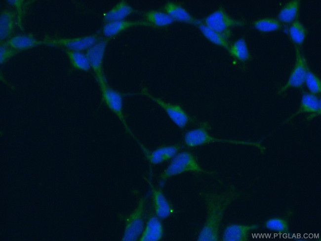 KGA Antibody in Immunocytochemistry (ICC/IF)