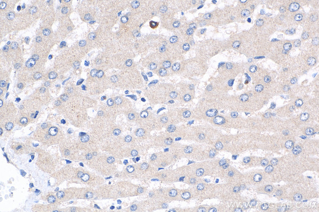 GLS2 Antibody in Immunohistochemistry (Paraffin) (IHC (P))