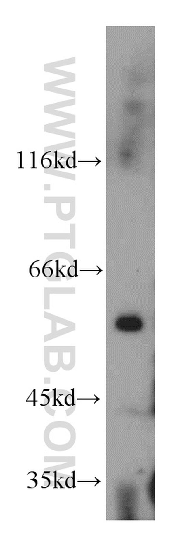 Trappc9/NIBP Antibody in Western Blot (WB)