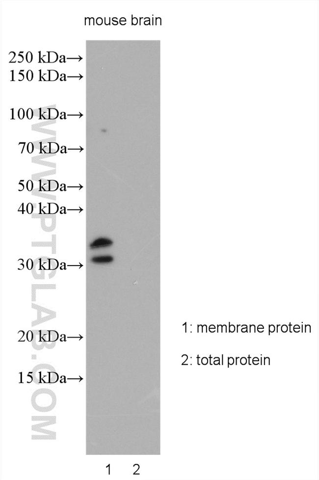 KCNIP2 Antibody in Western Blot (WB)
