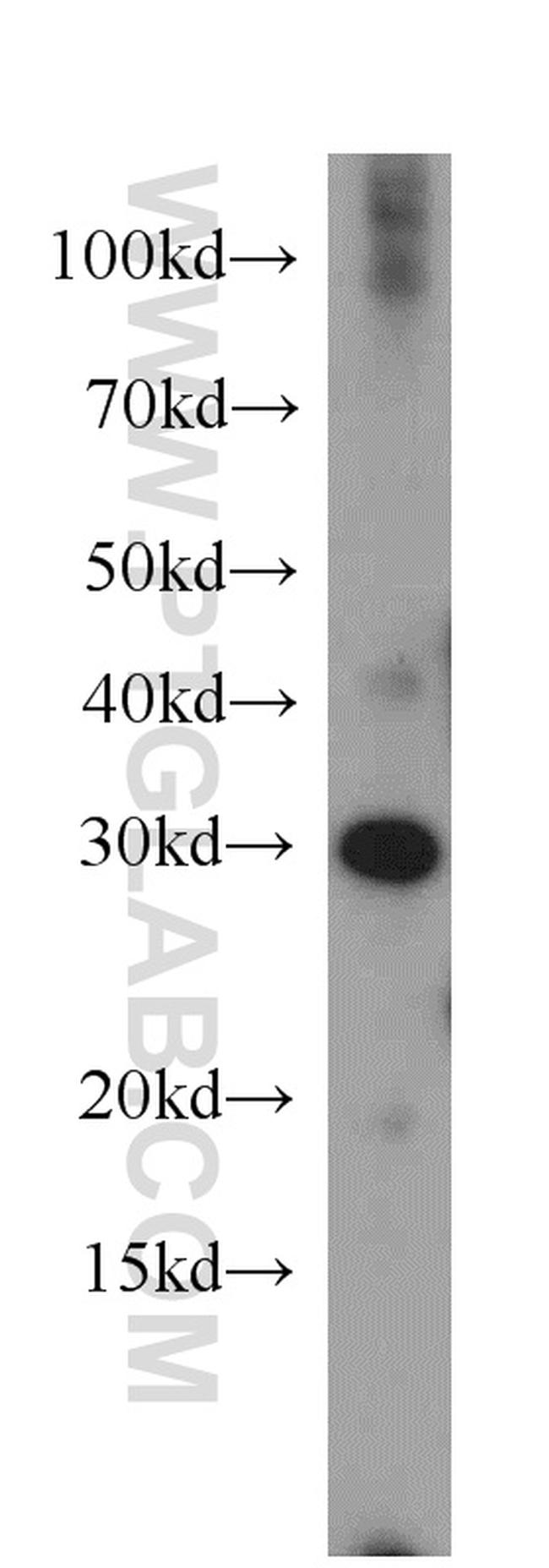 MRTO4 Antibody in Western Blot (WB)