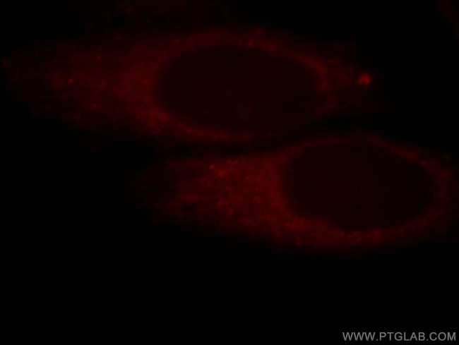 POTEA Antibody in Immunocytochemistry (ICC/IF)