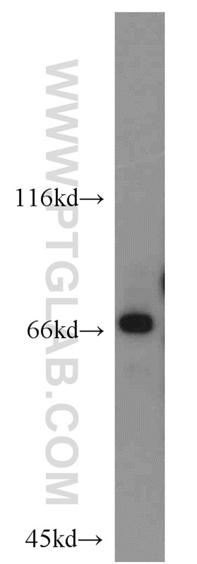 POTED Antibody in Western Blot (WB)